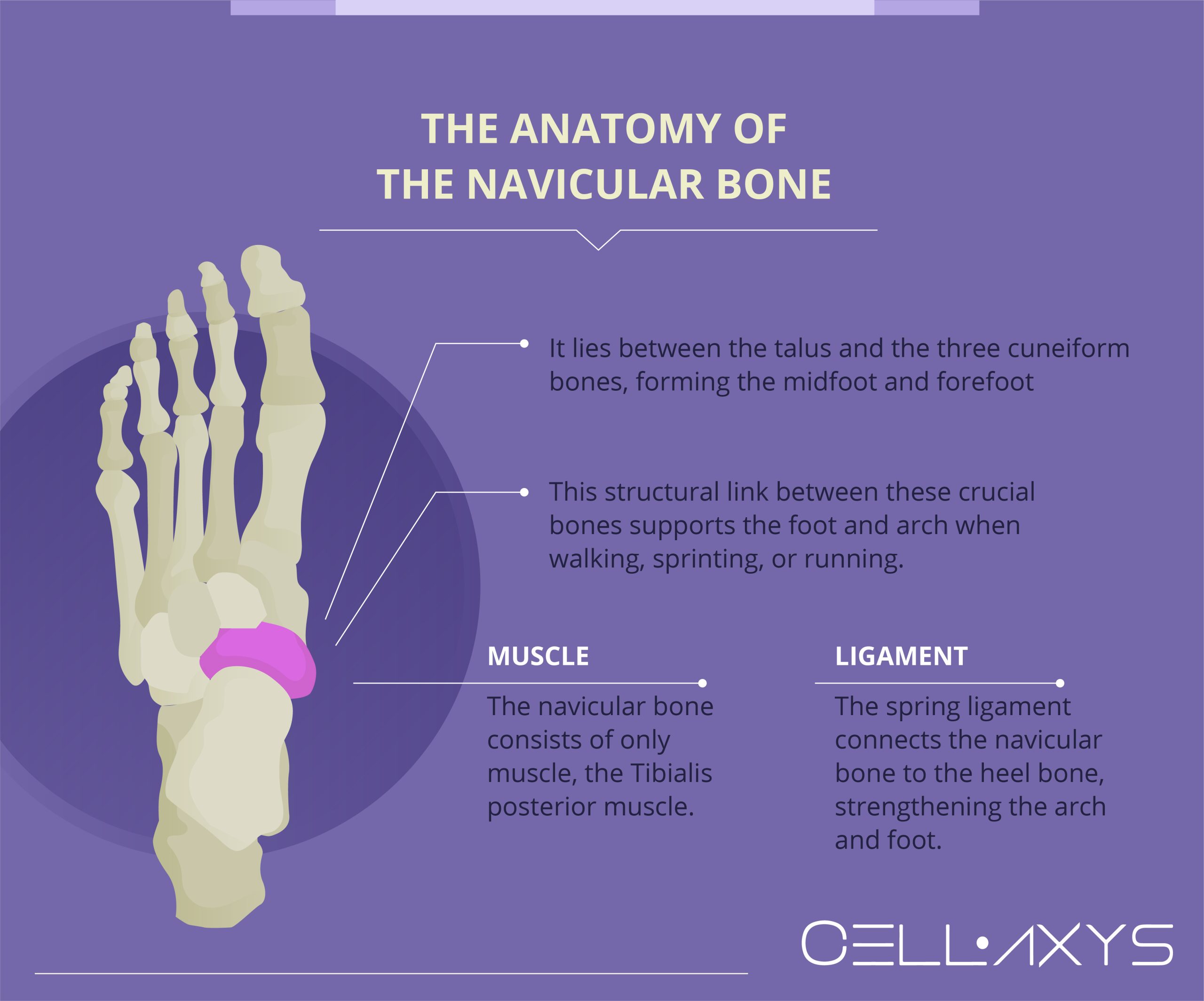 Broken Navicular Bone Treatment