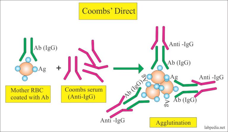 Coombs Test: Detecting Newborn Anemia Early