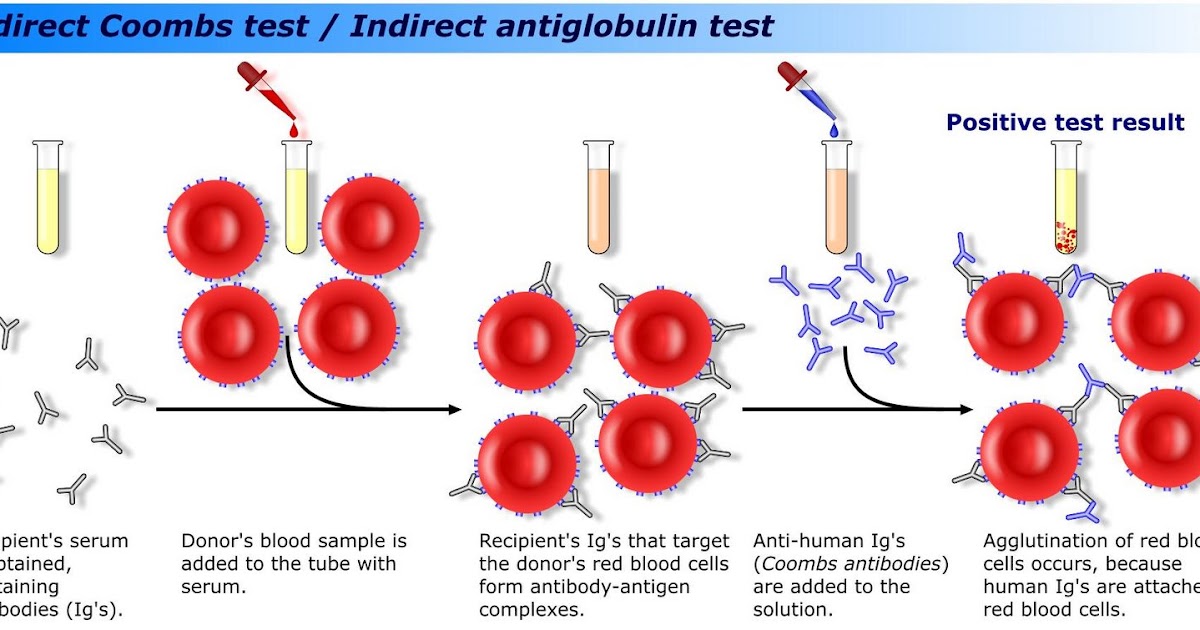 Coombs Test Guide: Diagnosis To Treatment Plan