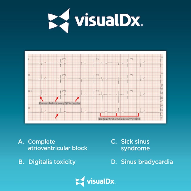 Dx Code For Fatigue: Diagnose & Treat Effectively