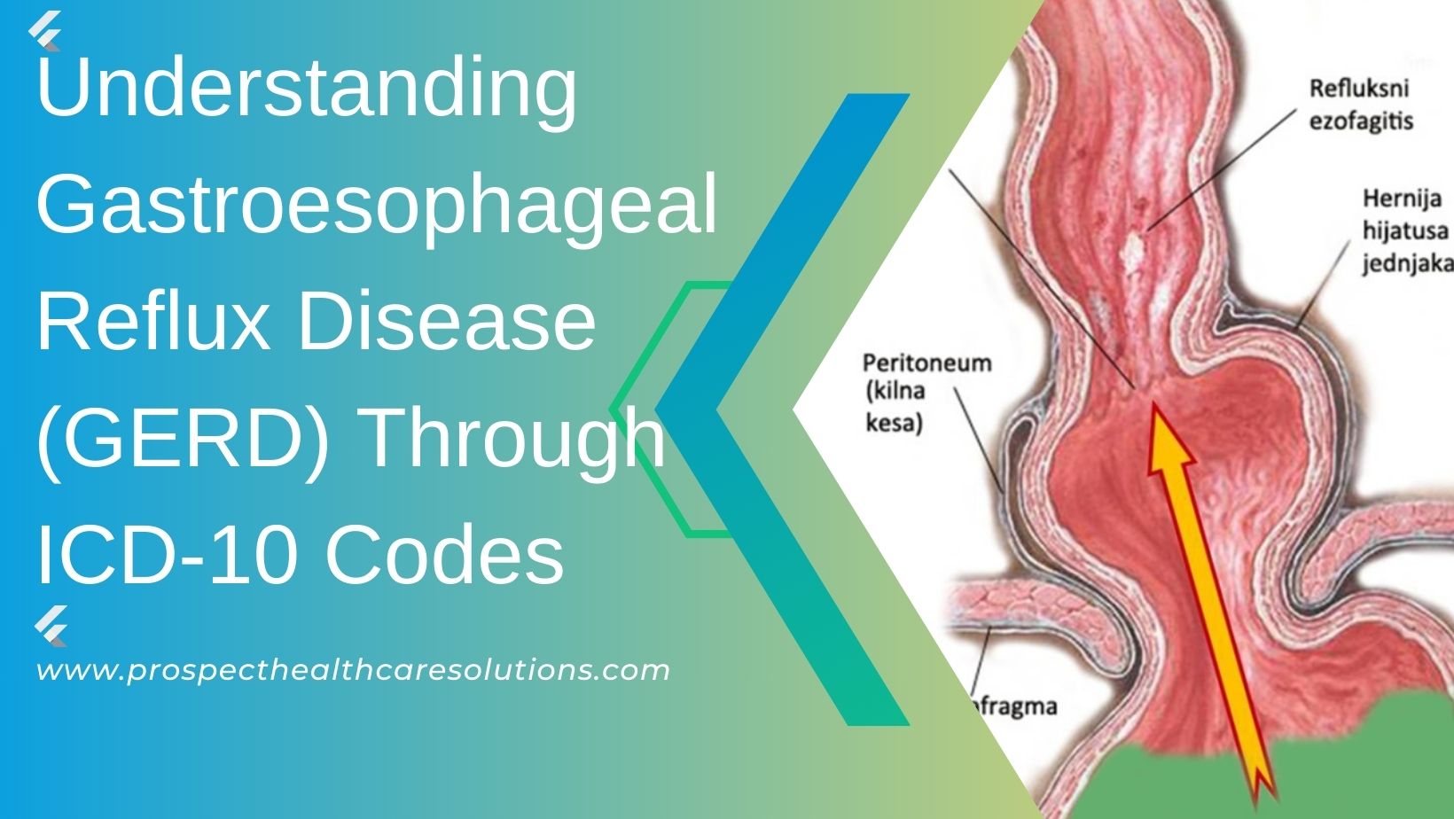 Esophageal Reflux Icd 10