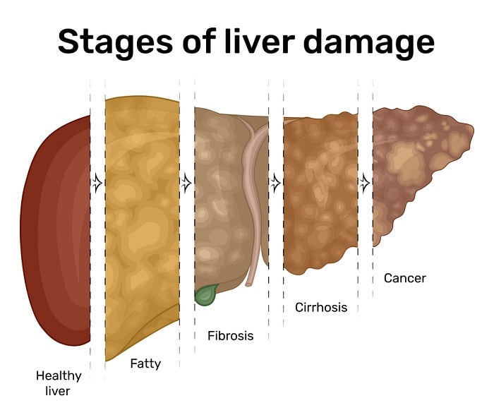 Fasting And Liver