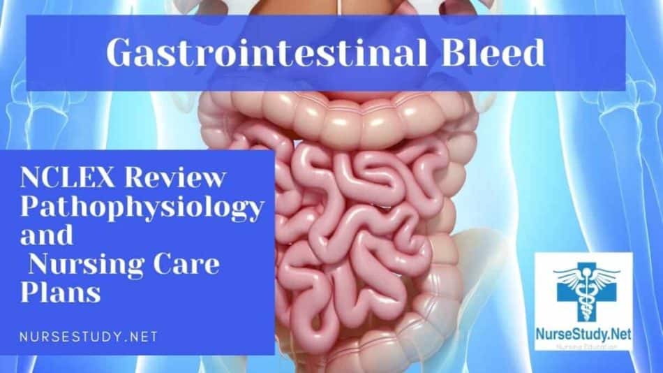 Gi Bleed Diagnosis Code