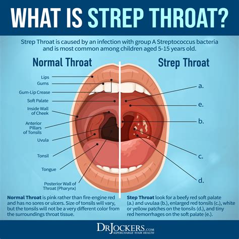 Healthy Back Of Throat: Identify Abnormalities Early