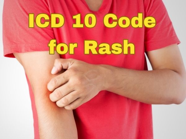Icd 10 Code Svt: Accurate Diagnosis Guide