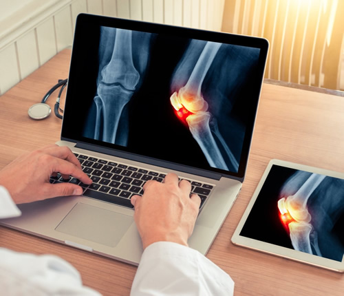Icd10 Code For Foot Pain: Get Accurate Diagnosis