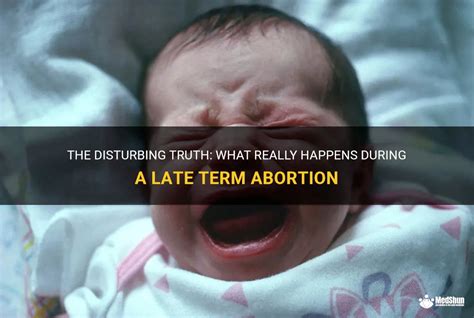 Late Term Abortion Photos