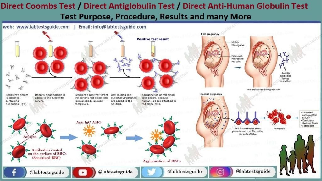 Newborn Coombs Test: Results And Treatment Explained Newborn Coombs Test: Results And Treatment Explained