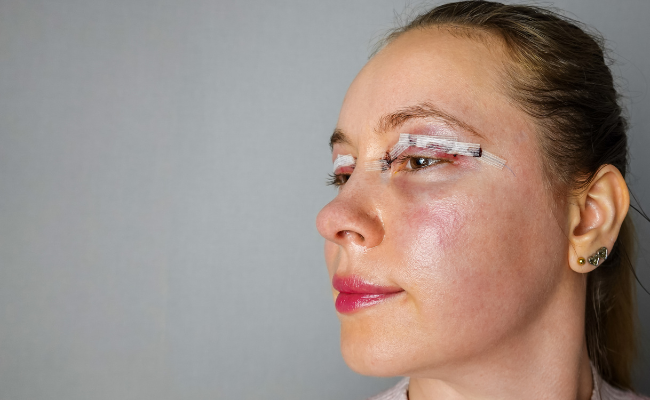 Newborn Eyelid Swelling: Quick Relief Solutions