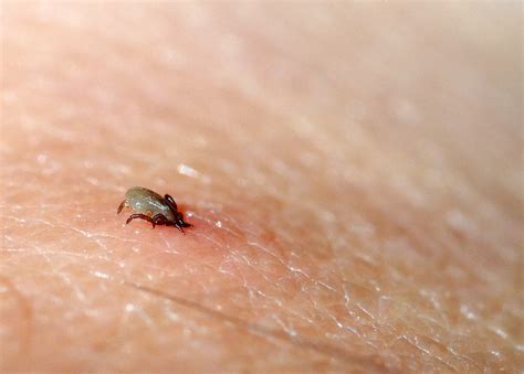Small Black Bug That Bites Small Black Bug That Bites
