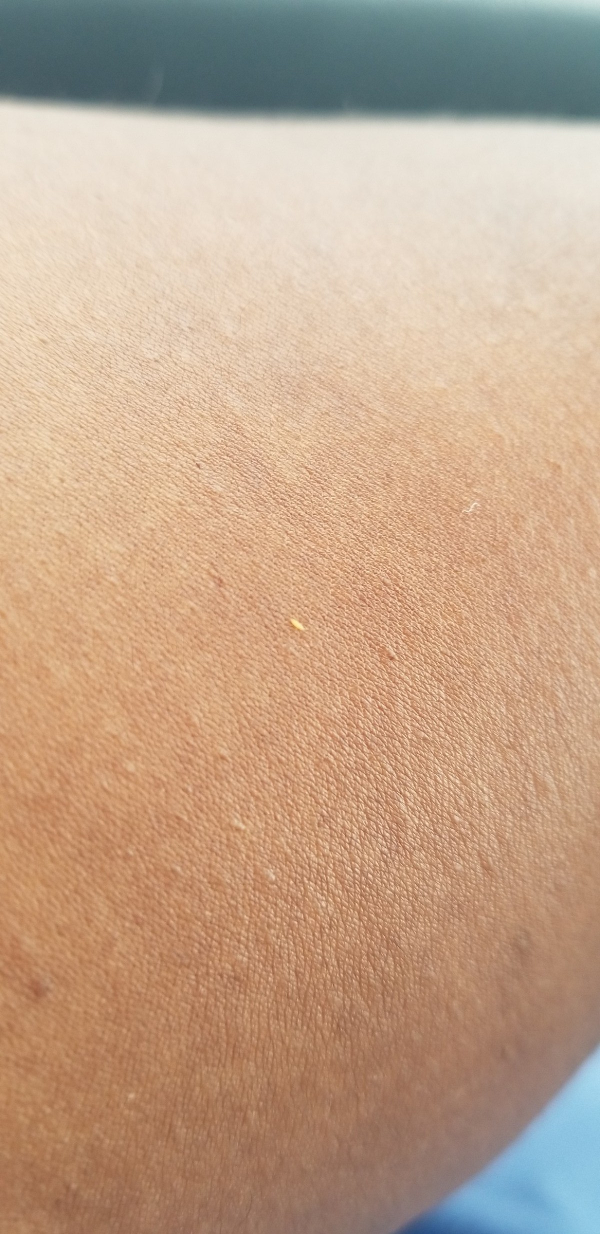 Tiny Orange Bugs: Effective Solutions To Get Rid