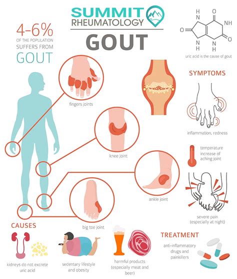 What Causes Gout With Red Beets? Natural Relief