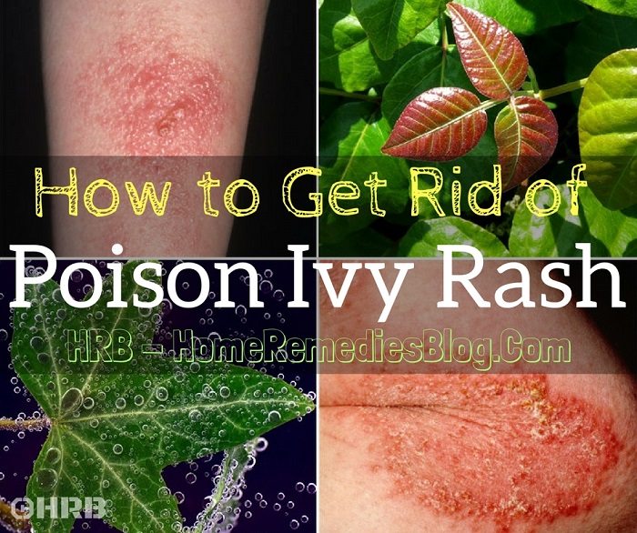 When Does Cedar Skin Rash Go Away? Fast Cure Guide