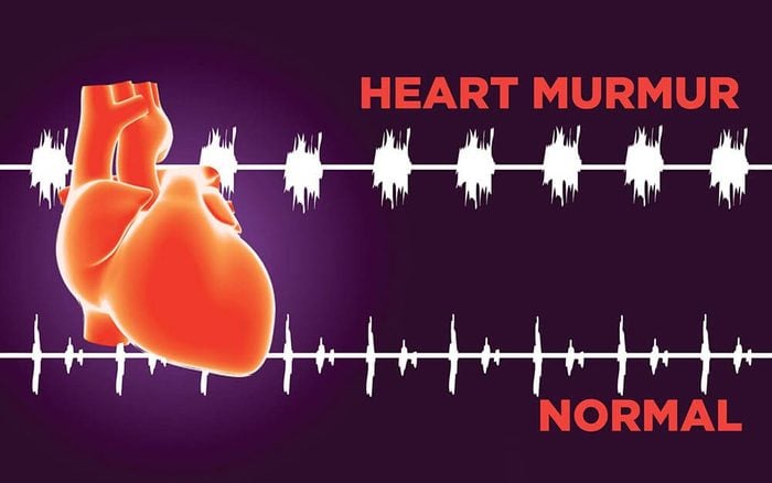 When Is A Slight Heart Murmur In Puppies A Concern?